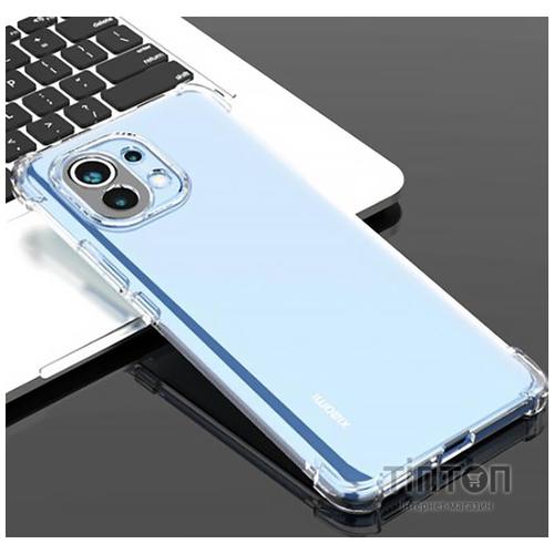 Чохол до мобільного телефона BeCover Anti-Shock Xiaomi Mi 11 Lite Clear (706073)