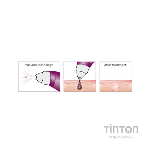 Масажер Beurer FC 41 (FC_41)