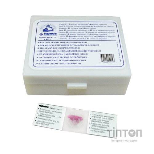 Набір мікропрепаратів Konus Патологічні тканини людського тіла, частина II 10 шт (4915)