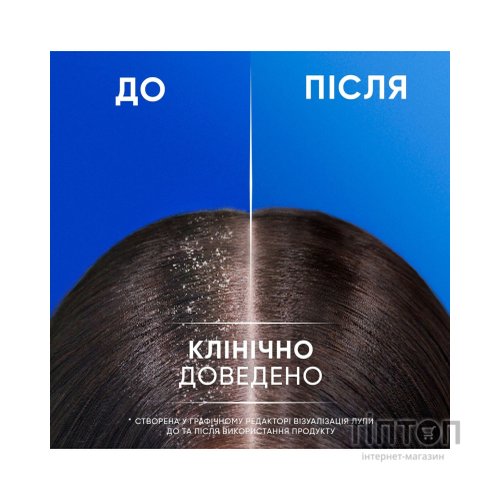 Шампунь Head & Shoulders 2 в 1 Проти лупи Яблучна свіжість 330 мл (8700216304689)