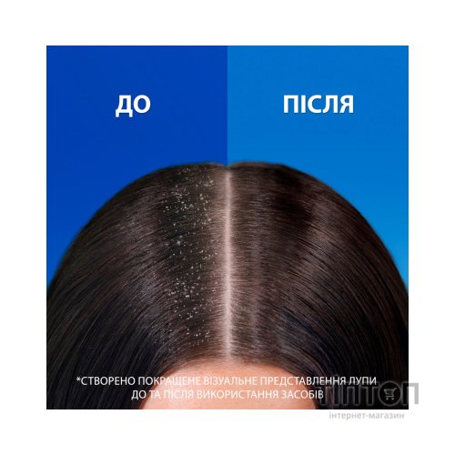 Шампунь Head & Shoulders Pro-Expert 7 Інтенсивний порятунок 250 мл (8700216156844)