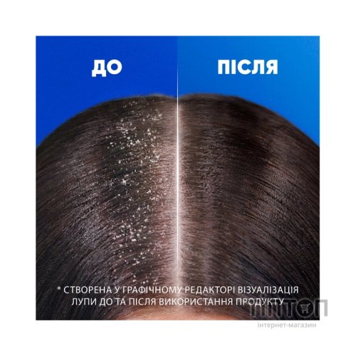 Шампунь Head & Shoulders Яблучна свіжість 400 мл (5410076659456)
